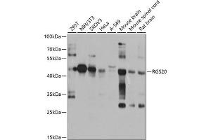 Western blot analysis of extracts of various cell lines, using RGS20 antibody (ABIN6132187, ABIN6146920, ABIN6146921 and ABIN6224191) at 1:1000 dilution. (RGS20 抗体  (AA 1-241))