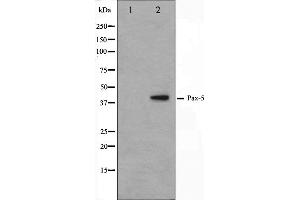 Western blot analysis on 293 cell lysate using Pax-5 Antibody. (PAX5 抗体  (N-Term))