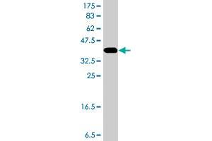 Western Blot detection against Immunogen (37 KDa) . (NEK6 抗体  (AA 1-100))