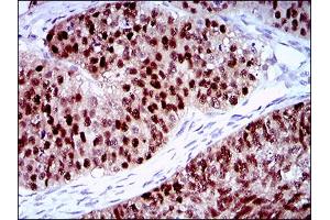 Immunohistochemistry (IHC) image for anti-Pleiomorphic Adenoma Gene-Like 1 (PLAGL1) (AA 118-222) antibody (ABIN1724869)