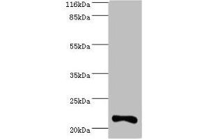 Western blot All lanes: IFNA10 antibody at 2 μg/mL + Mouse kidney tissue Secondary Goat polyclonal to rabbit IgG at 1/10000 dilution Predicted band size: 22 kDa Observed band size: 22 kDa (IFNA1 抗体  (AA 24-189))