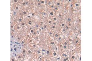 IHC-P analysis of liver tissue, with DAB staining. (Acetyl-CoA Carboxylase beta 抗体  (AA 29-249))