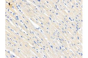 ABIN6265678 and ABIN6266689 at 1/100 staining Rat heart tissue by IHC-P. (TP53I11 抗体  (N-Term))