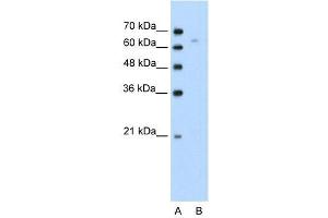Human Jurkat; WB Suggested Anti-TOX Antibody Titration: 0. (TOX 抗体  (N-Term))