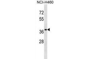Western Blotting (WB) image for anti-CutC Copper Transporter Homolog (CUTC) antibody (ABIN2999019) (CUTC 抗体)