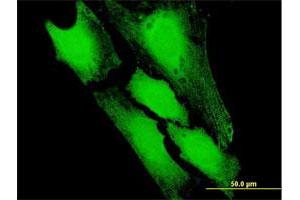 Immunofluorescence of purified MaxPab antibody to PFDN5 on HeLa cell. (PFDN5 抗体  (AA 1-154))
