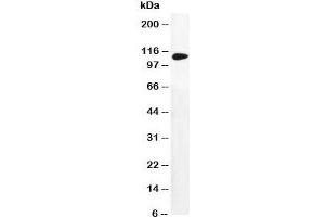 Western blot testing of DPYD antibody and MM231 cell lysate (DPYD 抗体  (AA 33-52))