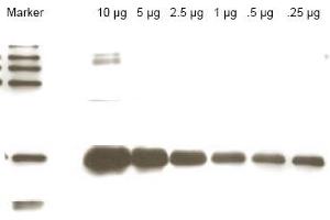 Western blot using anti-Yeast ULP-1 antibody shows detection of a truncated ULP-1 fusion protein (arrowhead). (ULP1 抗体)