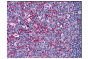 Human Tonsil: Formalin-Fixed, Paraffin-Embedded (FFPE) (Flotillin 2 抗体  (C-Term))