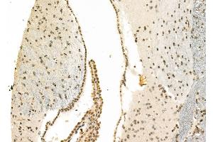 ABIN6260297 and ABIN6278198 at 1/100 staining Mouse brain tissue by IHC-P. (BNIP3L/NIX 抗体  (Internal Region))