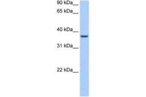 Western Blotting (WB) image for anti-AlkB, Alkylation Repair Homolog 8 (ALKBH8) antibody (ABIN2462329) (ALKBH8 抗体)