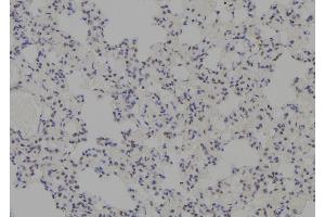 ABIN6277745 at 1/100 staining Rat lung tissue by IHC-P. (MDM4-binding Protein 抗体  (Internal Region))