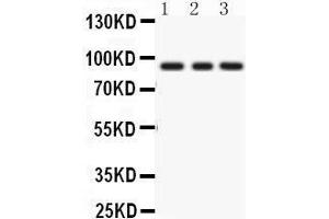 Western Blotting (WB) image for anti-Protein Kinase C, epsilon (PRKCE) (AA 53-236) antibody (ABIN3043908)