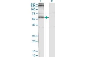 Western Blot analysis of CHRND expression in transfected 293T cell line by CHRND monoclonal antibody (M01), clone 2B2. (CHRND 抗体  (AA 24-130))