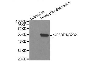 Western blot analysis of extracts from 293 cells, using Phospho-G3BP1-S232 antibody (ABIN2988019).