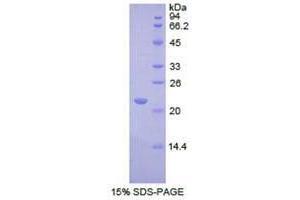 SDS-PAGE analysis of Human REXO2 Protein. (REXO2 蛋白)