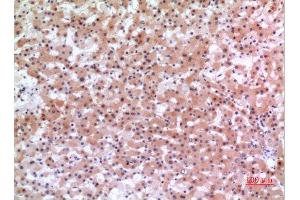 Immunohistochemistry (IHC) analysis of paraffin-embedded Human Liver, antibody was diluted at 1:100. (INHBE 抗体  (C-Term))