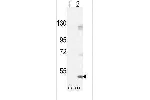 Western blot analysis of FGFR1 (arrow) using rabbit polyclonal FGFR1-p h. (FGFR1 抗体  (AA 132-161))