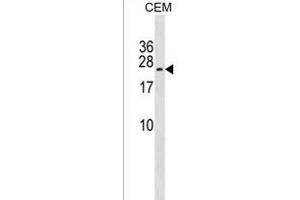 TAK1L Antibody (C-term) (ABIN1536861 and ABIN2838127) western blot analysis in CEM cell line lysates (35 μg/lane). (MAP3K7CL 抗体  (C-Term))