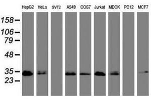 Image no. 3 for anti-Palmitoyl-Protein Thioesterase 1 (PPT1) (AA 100-306) antibody (ABIN1490801) (PPT1 抗体  (AA 100-306))