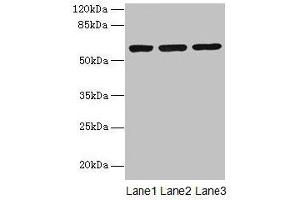 Western blot All lanes: MIER2 antibody at 4 μg/mL Lane 1: Jurkat whole cell lysate Lane 2: HepG2 whole cell lysate Lane 3: A549 whole cell lysate Secondary Goat polyclonal to rabbit IgG at 1/10000 dilution Predicted band size: 60 kDa Observed band size: 60 kDa (MIER2 抗体  (AA 1-545))