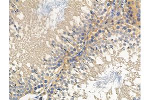 ABIN6256975 and ABIN6275033 at 1/100 staining Rat testis tissue by IHC-P. (C1QBP 抗体  (Internal Region))