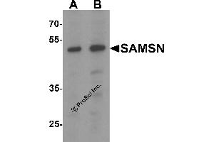 Western Blotting (WB) image for anti-SAM Domain, SH3 Domain and Nuclear Localization Signals, 1 (SAMSN1) (C-Term) antibody (ABIN1077391)