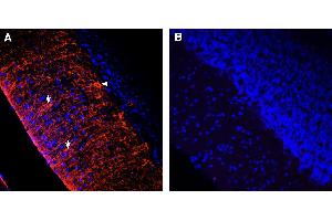 Comparison of immunostaining with SSTR1 compared to immunostaining with isotype control antibody in rat cortex. (兔 IgG 同型对照)