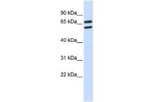 TRIML1 antibody used at 1 ug/ml to detect target protein. (TRIML1 抗体  (Middle Region))