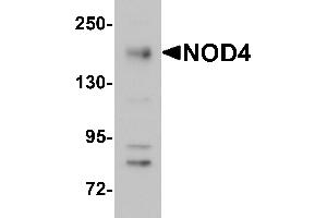 Western Blotting (WB) image for anti-NLR Family, CARD Domain Containing 5 (NLRC5) (N-Term) antibody (ABIN1031483) (NLRC5 抗体  (N-Term))