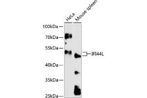 Western blot analysis of extracts of various cell lines, using IFI44L antibody (ABIN6130508, ABIN6142170, ABIN6142171 and ABIN6217125) at 1:3000 dilution. (IFI44L 抗体  (AA 1-200))