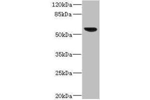 Western blot All lanes: SOAT2 antibody IgG at 3.