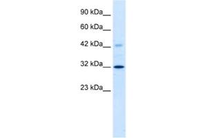 Western Blotting (WB) image for anti-Voltage-Dependent Anion Channel 1 (VDAC1) antibody (ABIN2461102) (VDAC1 抗体)