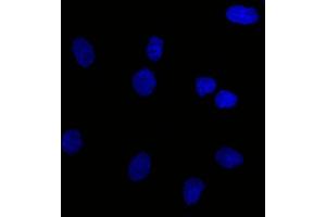 Confocal Immunofluorescent analysis of SK-OV-3 cells using CF488-labeled Isotype Control Mouse Monoclonal Antibody IgG1-(Green). (EpCAM 抗体  (N-Term) (CF®488A))