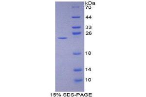 SDS-PAGE (SDS) image for Neutrophil Cytosolic Factor 2 (NCF2) (AA 355-526) protein (His tag) (ABIN2126070)