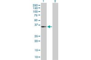 Western Blot analysis of CENPH expression in transfected 293T cell line by CENPH MaxPab polyclonal antibody. (CENPH 抗体  (AA 1-247))