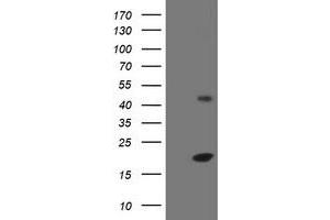 Image no. 1 for anti-Eukaryotic Translation Initiation Factor 5A2 (EIF5A2) antibody (ABIN1497998) (EIF5A2 抗体)
