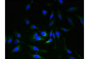 Immunofluorescent analysis of Hela cells using ABIN7151699 at dilution of 1:100 and Alexa Fluor 488-congugated AffiniPure Goat Anti-Rabbit IgG(H+L) (ERGIC3 抗体  (AA 47-341))