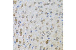 Immunohistochemistry of paraffin-embedded rat brain using BTD antibody at dilution of 1:100 (40x lens). (BTD 抗体)
