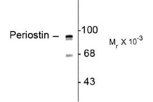 Image no. 1 for anti-Periostin (POSTN) (C-Term) antibody (ABIN372700) (Periostin 抗体  (C-Term))