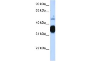 Western Blotting (WB) image for anti-Fast Skeletal Troponin T (TNNT3) antibody (ABIN2463422) (TNNT3 抗体)