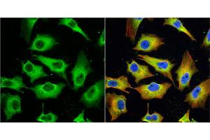 ICC/IF Image MX1 antibody [N2C2], Internal detects MX1 protein at cytoplasm by immunofluorescent analysis. (MX1 抗体  (Internal Region))