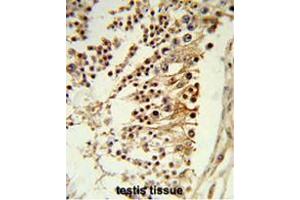 Formalin-fixed and paraffin-embedded human testis tissue reacted with CENPH Antibody (Center), which was peroxidase-conjugated to the secondary antibody, followed by DAB staining. (CENPH 抗体  (Middle Region))