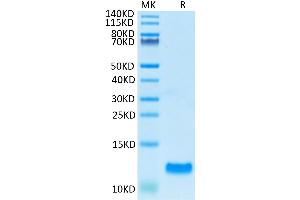 Human CCL20 on Tris-Bis PAGE under reduced condition. (CCL20 Protein (AA 27-96) (His tag))