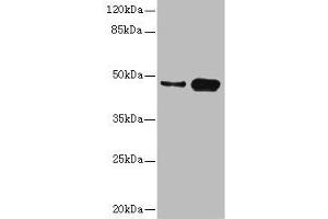 Western blot All lanes: CSNK1G2 antibody at 4. (Casein Kinase 1 gamma 2 抗体  (Isoform gamma 2))