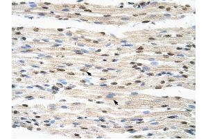 HNRPDL antibody was used for immunohistochemistry at a concentration of 4-8 ug/ml to stain Skeletal muscle cells (arrows) in Human Muscle. (HNRPDL 抗体  (Middle Region))