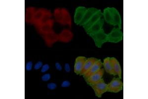 ABIN6263727 and ABIN6272622 staining Hela cells(24h of starvation treatment) by IF/ICC.