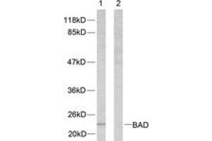 Western blot analysis of extracts from 293 cells, treated with Forskolin, using BAD (Ab-112) Antibody. (BAD 抗体  (AA 78-127))