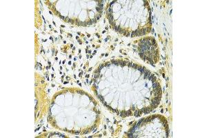 Immunohistochemistry of paraffin-embedded human colon using SLC25A1 antibody. (Slc25a1 抗体  (AA 1-311))