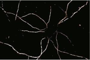 Immunofluorescence staining of rat neurons. (Striatin 抗体  (AA 450-600))